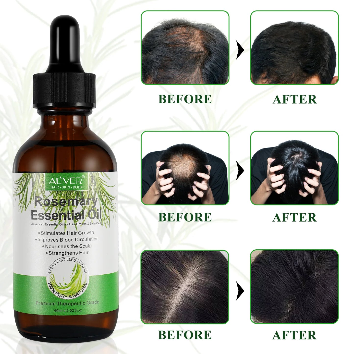Aliver Rosemary Essential Oil for Hair and Skin Care, Massage Oil with a Silicone Massage Comb, Improve Scalp Blood Circulation,Promote Nutrient Absorption