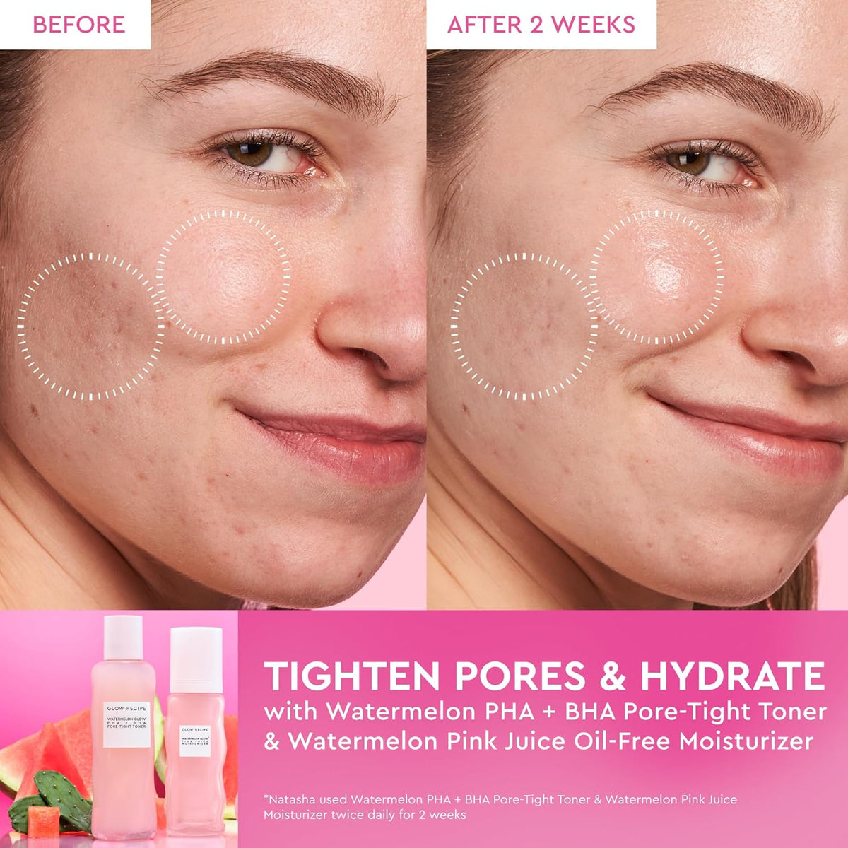 Glow Recipe Pink Juice Water Gel Moisturizer, Korean Gel Moisturizer for Glass Skin, Oil-Free Hydrating Hyaluronic Acid Face Moisturizer for Oily Skin, Non-Comedogenic, Long-Lasting (50Ml)