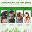 Aliver Rosemary Essential Oil for Hair and Skin Care, Massage Oil with a Silicone Massage Comb, Improve Scalp Blood Circulation,Promote Nutrient Absorption