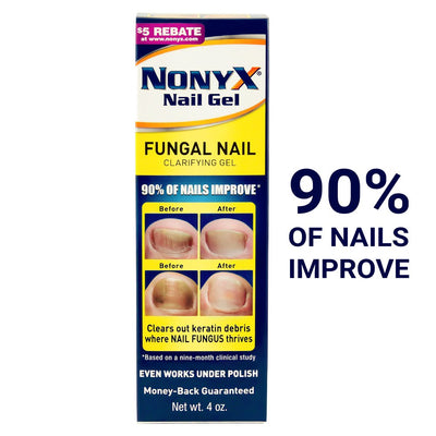 Nonyx Fungal Nail Clarifying Gel - Rids Toenails of Fungus by Removing Keratin Debris Where Nail Fungus Grows, 4 Oz.